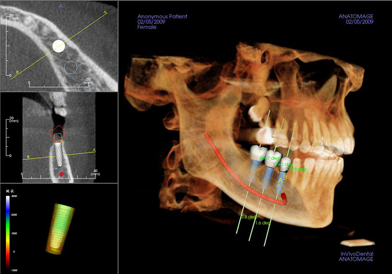 Image of a digital x-ray